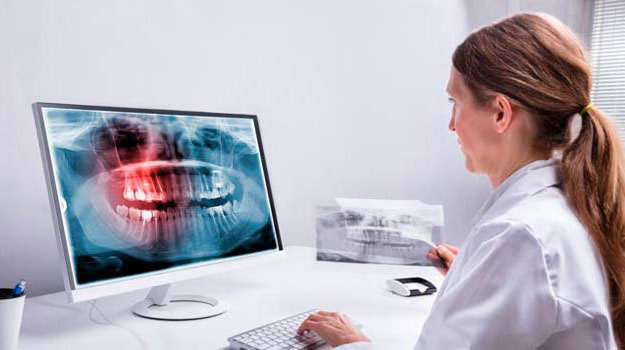 Female Dentist Examining The Patient Teeth X-ray